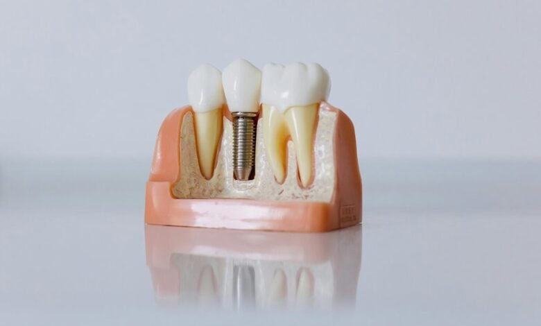 hungary dental implant services