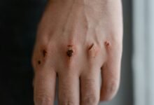 qexilkizmor skin safety tips